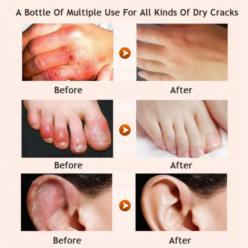 Honey Moisturizing Foot & Leg Cream – Nourishing Repair Cream with Honey & Avocado Extract for Dry, Cracked Skin