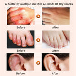 Honey Moisturizing Foot & Leg Cream – Nourishing Repair Cream with Honey & Avocado Extract for Dry, Cracked Skin